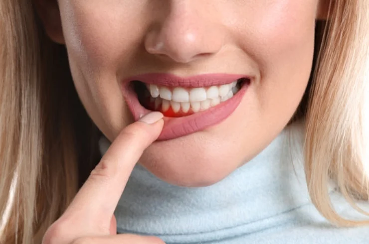 GUM
